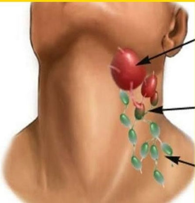 How to Unclog your Lymph Nodes Naturally